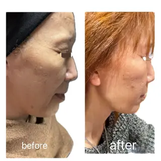 IYASHI所属・IYASHI れなのエステ・リラクイメージ