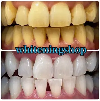 ホワイトニング ショップ吉祥寺店のエステ・リラクイメージ