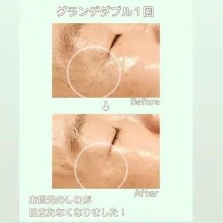 ラブニール 恵比寿店のエステ・リラクイメージ