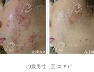 調律エステ /美KISSのその他イメージ