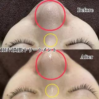 Beauty salon Guri's korugi所属・Guri's korugiのエステ・リラクイメージ