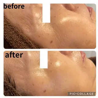 VIBLISS. ヴィブリスのエステ・リラクイメージ