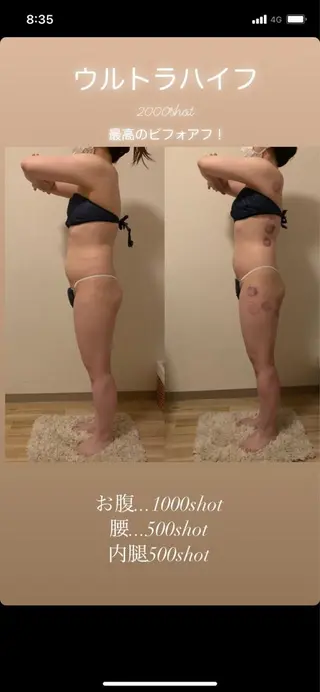 a room salonのエステ・リラクイメージ