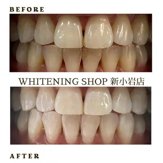 メンズ ホワイトニング ショップ新小岩店のその他イメージ
