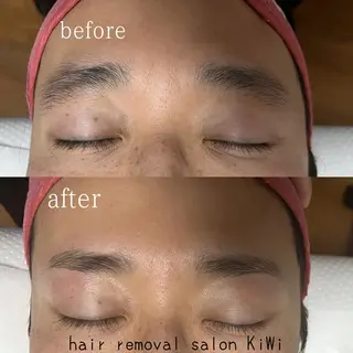 アイブロウ 脱毛サロン KiWiのエステ・リラクイメージ