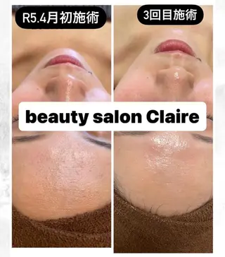 ビューティーサロン Claireのエステ・リラクイメージ