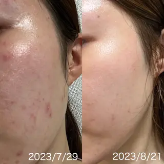 ナリス化粧品　岡山デアイム所属・De I'm Salonのエステ・リラクイメージ