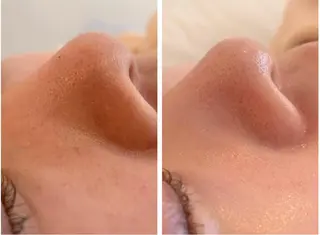 小顔&デコルテ Spa　“koti”のエステ・リラクイメージ