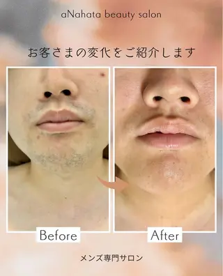 メンズ aNahata beauty salon所属・田中 菜月のエステ・リラクイメージ