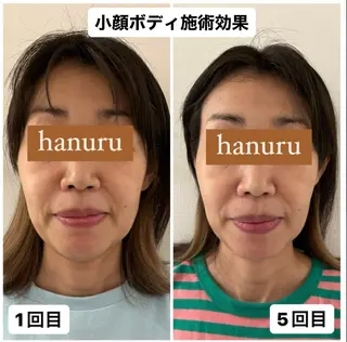 美容整体・小顔矯正 hanuruのエステ・リラクイメージ