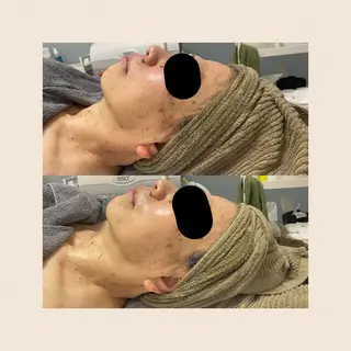 salon_ A所属・MAE ASUKAのエステ・リラクイメージ