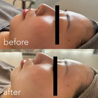 エステティックサロン Liente(リアンテ)所属・Hashimoto .のエステ・リラクイメージ