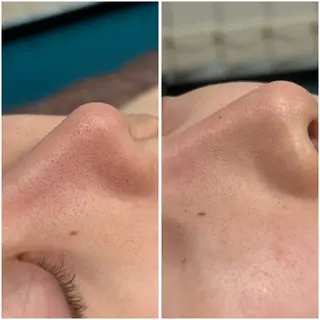 re.make所属・小顔美肌💖痩身☃️ ユキナ🤍のエステ・リラクイメージ