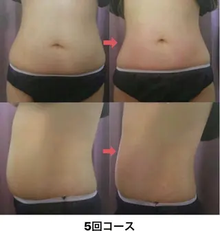 横浜エステサロン R-ing　リングのエステ・リラクイメージ