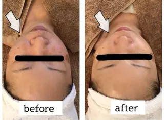 肌悩み改善 〜エステサロン〜のエステ・リラクイメージ