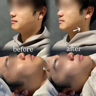 🪞Purasia. 🫧韓国肌管理💎の眉毛・アイブロウイメージ