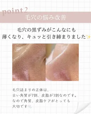 ニキビ毛穴専門店Beautysalon Luana所属・小林 まいのエステ・リラクイメージ