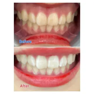 MBEAUTYSALON 千葉店・京成大久保所属・Melty 輝のその他イメージ