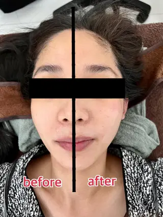 小顔・ツルツル素肌 ハリステリアのエステ・リラクイメージ