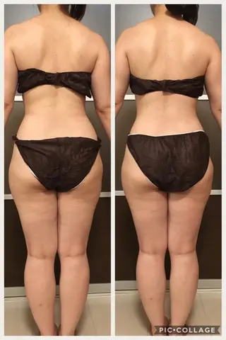 ミディアム カラー パーマ ヘアアレンジ メンズ キッズ ネイル マツエク・マツパ アニメ,Vオタク× 即効痩せエステサロンのエステ・リラクイメージ