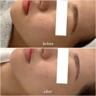 肌質改善 ￤ POLA￤カワナベのエステ・リラクイメージ