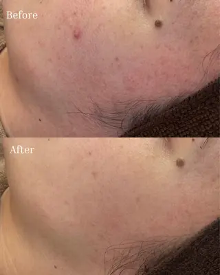 BELLIS HUIT所属・ハーブピーリング那覇 BELLISHUITのエステ・リラクイメージ