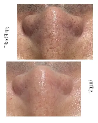 脱毛・肌質改善サロン Linoのエステ・リラクイメージ