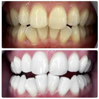 メンズ LOVEホワイト ニング恵比寿店のその他イメージ