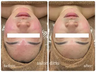 salon ditto所属・mio (小顔・ヘッドスパ)のエステ・リラクイメージ