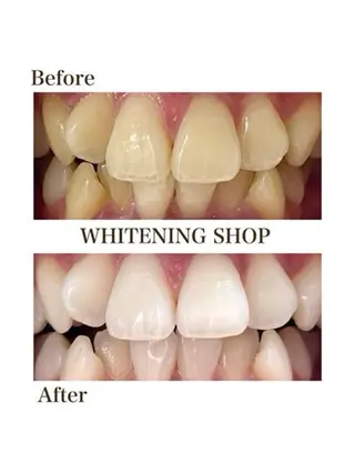 ホワイトニングショップ津店所属・ホワイトニング ショップ津店のその他イメージ