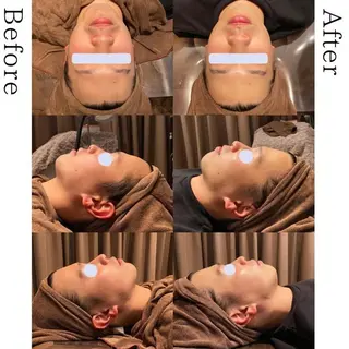 【Folche 春日店】馬場・大内田のエステ・リラクイメージ