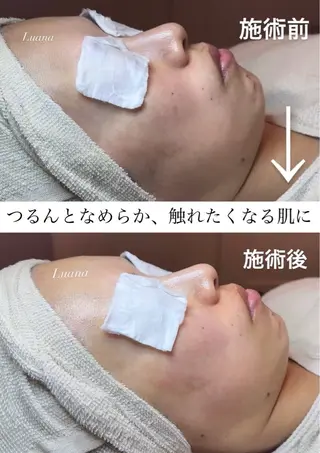 マツヤニWax専門/ 岸和田/Luanaのエステ・リラクイメージ