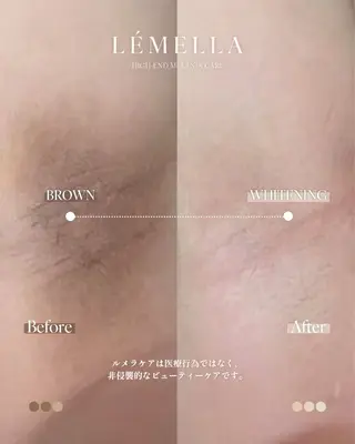 メラニンケアサロンM/é（エムエ）所属・メラニンケア M/é柴田のその他イメージ