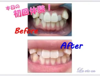 セルフホワイトニングサロン　ラヴィアン所属・ホワイトニングサロン La vie enのその他イメージ