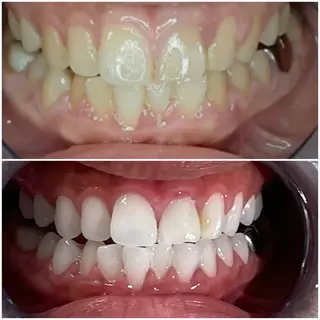 五十嵐 蓮のその他イメージ