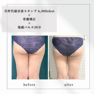 小顔矯正専門店 【RED】池田のエステ・リラクイメージ