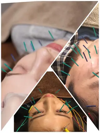 表参道鍼灸院K 美容鍼🔮ララピールのエステ・リラクイメージ