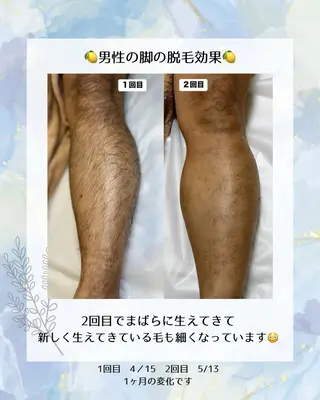 メンズ エステサロン lx (ルクス)所属・エステサロン lx(ルクス)のエステ・リラクイメージ