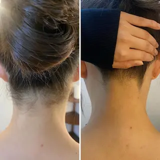 うなじ脱毛/美肌脱毛 LABELのエステ・リラクイメージ