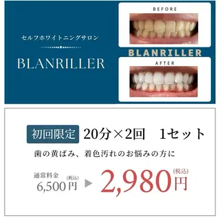 BLANRILLER所属・ホワイトニングサロン ブランリエ阿倍野店のその他イメージ