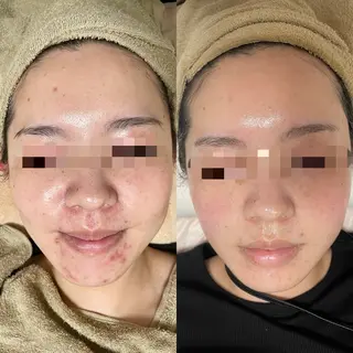 プライベートサロン Belle（ベル）のエステ・リラクイメージ