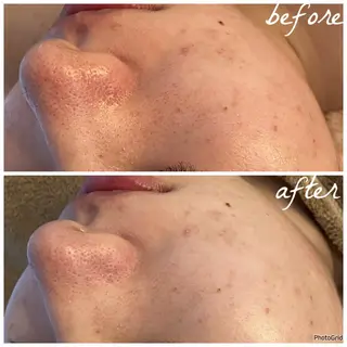 メンズ メナード岐阜市茜部 杉浦のエステ・リラクイメージ