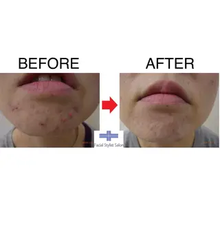 肌質改善専門 鈴木悠のエステ・リラクイメージ