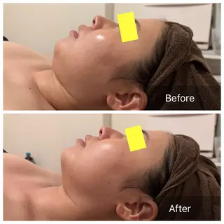 LIAN Beauty Salon所属・LIAN リアンのエステ・リラクイメージ