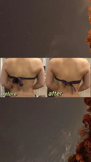 浮腫|肩こり|張り 日々の疲れを解消⭐️のエステ・リラクイメージ