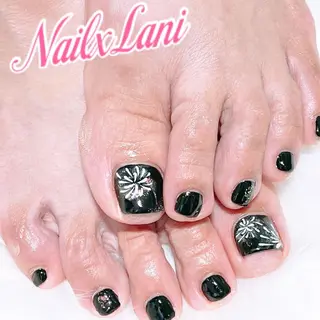 ネイル 練馬駅近ネイルラニ 不細工爪90分で美爪のネイルデザイン