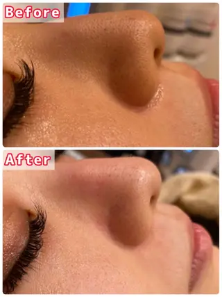 ハーブピーリング専門 muro.のエステ・リラクイメージ