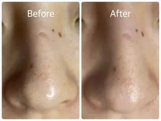 salon HATOのエステ・リラクイメージ