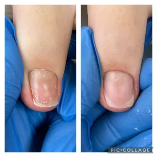 ネイル Estotibi エストティビのその他イメージ