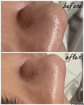 メンズ メナード岐阜市茜部 杉浦のエステ・リラクイメージ